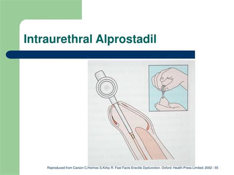 Using Muse Suppository 的图像结果