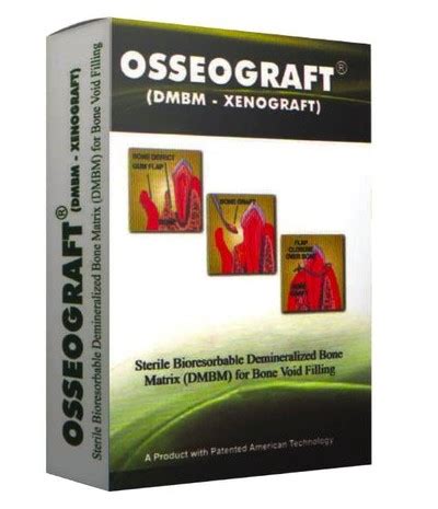 Dental Implant materials, equipment, instruments in Cochin - Dental ...