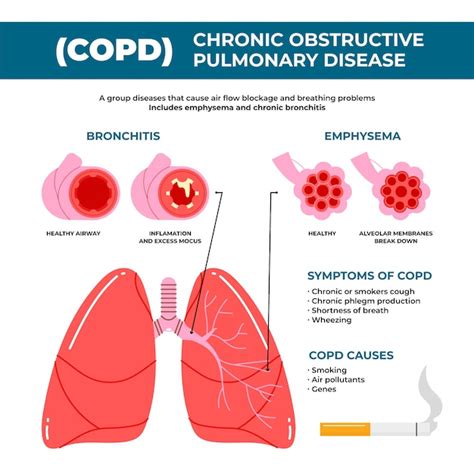 Flat-hand getekende copd infographic | Gratis Vector