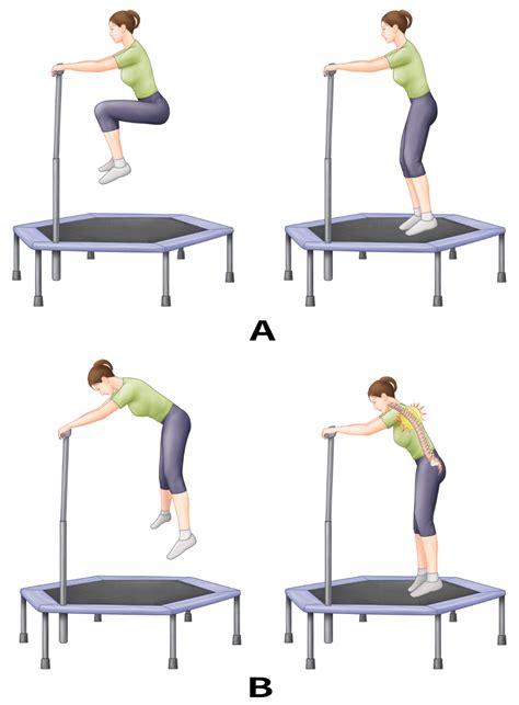 Mid-Thoracic Vertebral Compression Fracture after Mini-Trampoline Exercise: A Case Series of ...