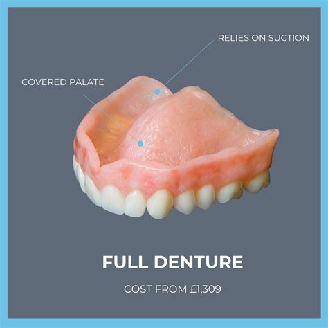 Cost Of Upper Denture Implants Cost Of Dental Implants Dr Alex