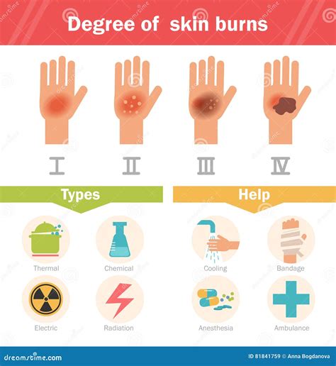 Primer Grado Quemaduras at Harry Northcott blog