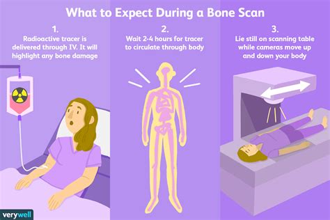 Bone Scan Testing 的图像结果
