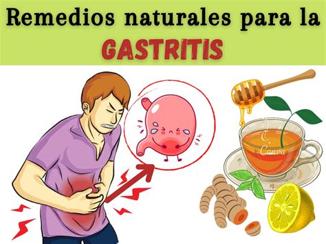 Remedios Caseros Para La Gastritis