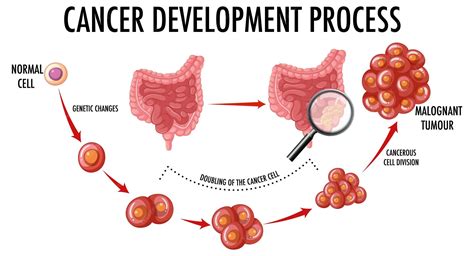 Malignant Cells Diagram
