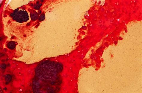¿Es normal tener sangre en la orina? Cuándo debes consultar | Blogs ...