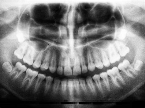 Why Do My Teeth & Gums Hurt? - Eagle Dental Care