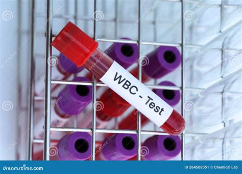WBC Test To Look for Abnormalities from Blood Stock Image - Image of laboratory, complete: 264508051