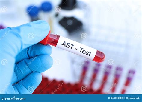 AST Blood Test 的图像结果