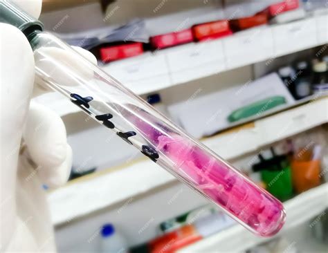 Triple Sugar Iron Agar