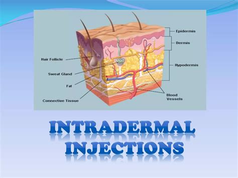 INTRADERMAL INJECTION | PDF