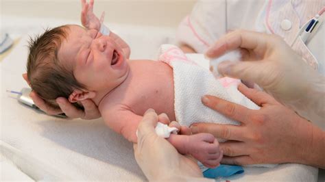 Baby Delivery Process 的图像结果