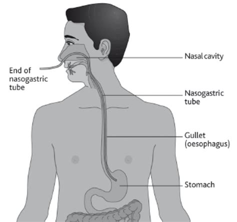 Methods of administering drugs into the body - ePharmacology | HubPages