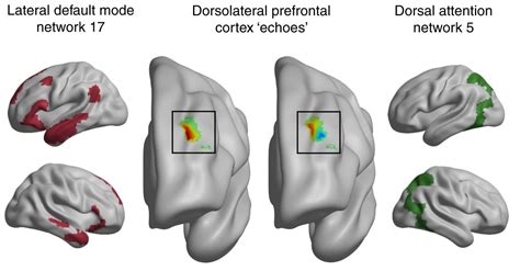 Image result for Dorsolateral Prefrontal Cortex