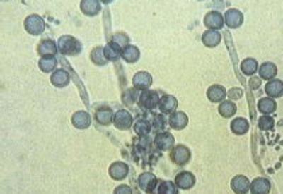 一种子囊菌纲Filobasidium属的真菌及其应用_2