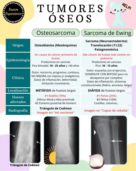 Cuadro De Evolución Con Ewing Tratamiento De Las Neoplasias
