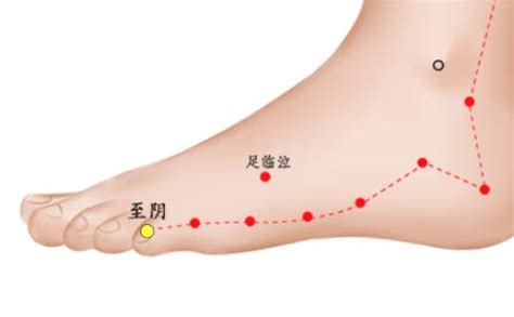 脚面刺瘊恢复过程图