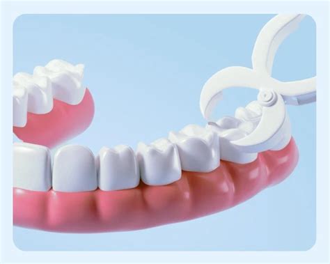 Image result for Basic Tooth Extraction