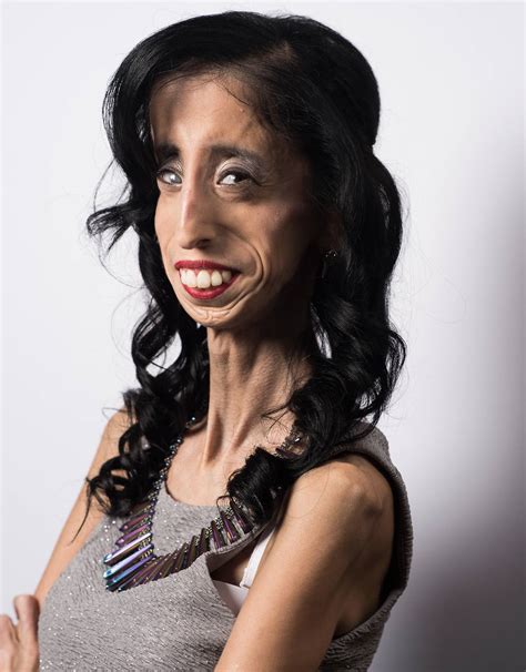 'Online bullies called me the world's ugliest woman' - Lizzie Velasquez ...