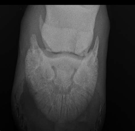 Equine Navicular Bone Fracture