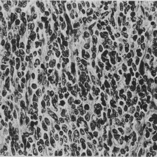 Image result for String Pattern in JavaScript