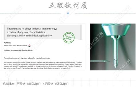 德国ABT种植体之ICE好不好？编号为ICE的这款种植牙是什么档次 - 美佳社区