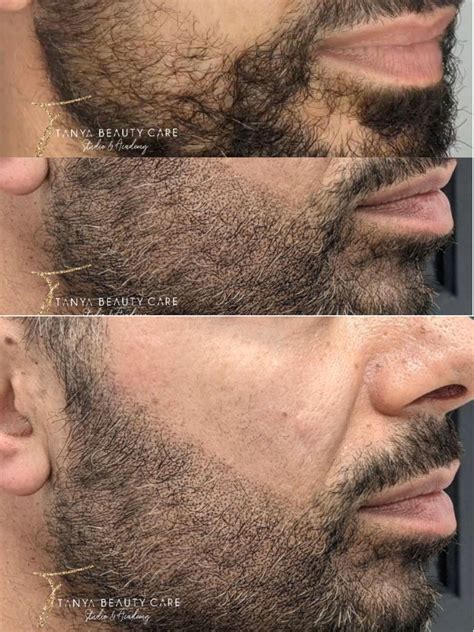 Image result for Microblading Beard