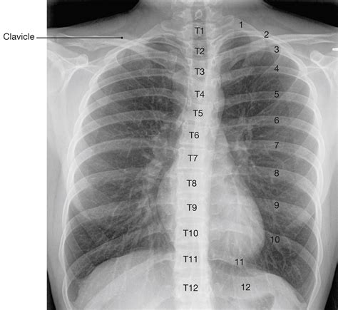 Thorax - Clinical Tree