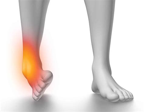 ankle-sprains-2 - The Doctors Of Physical Therapy