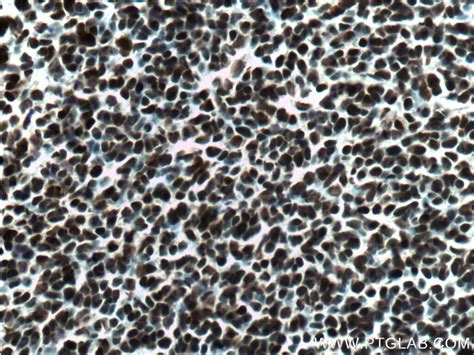 SOX2 antibody (66411-1-Ig) | Proteintech