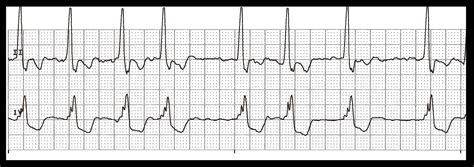 Image result for Solving Routine ND Non-Routine