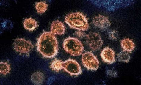 New 'Langya Virus' Similar To Nipah Found In 35 Patients In China ...