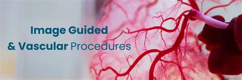 Advanced Holistic Care in Image-Guided and Vascular Procedures