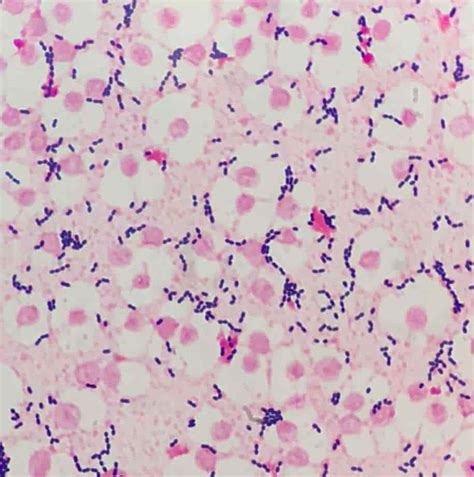 Image result for Enterococcus Faecalis Journal