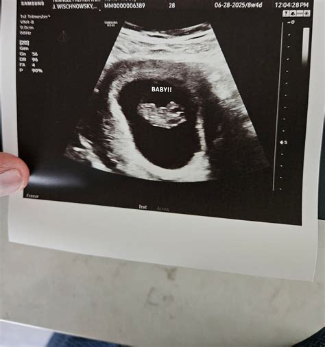 9 week Ultrasound GIRL or BOY ? | BabyCenter