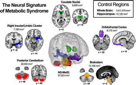 Frontiers | Metabolic syndrome predictors of brain gray matter volume in an age-stratified ...