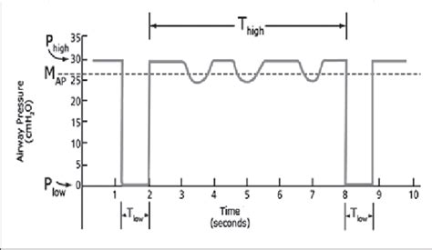 APRV Mode Explained 的图像结果