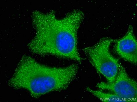FGFR3 antibody (66954-1-Ig) | Proteintech