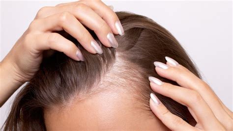 Signs of New Hair Growth: How to Know Your Hair is Growing Healthy