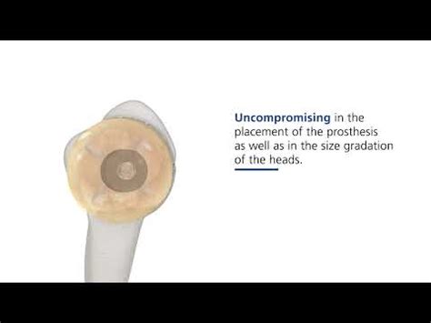 Affinis Short | Shoulder Prosthesis – Enovis Surgical
