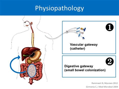 Image result for Colon Polyps Types