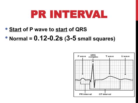 normal ECG interpretation presentation.ppt