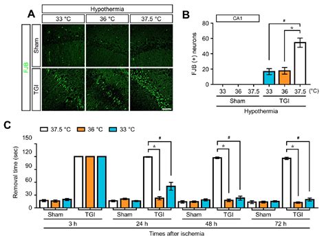 Transient Global Ischemia-Induced Brain Inflammatory Cascades ...
