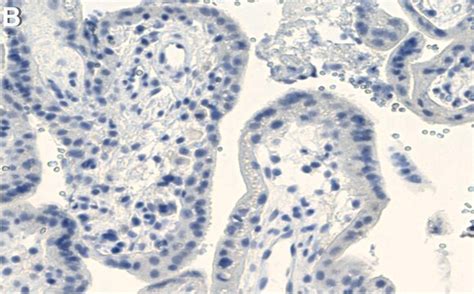 Anti-Laminin b1 Antibody, clone 4E10 ZooMAb Mouse Monoclonal Sigma-Aldrich