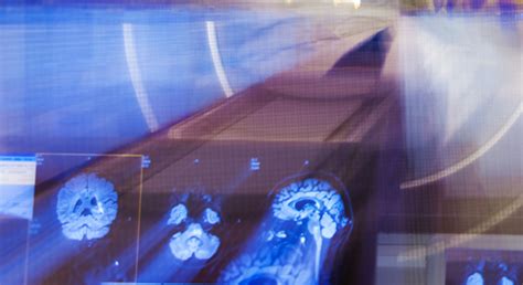 AI could be our radiologists of the future, amid a healthcare staff crisis