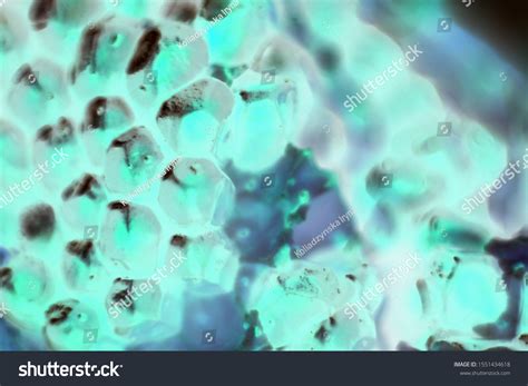 Bacteria Reproducing Under a Microscope 的图像结果