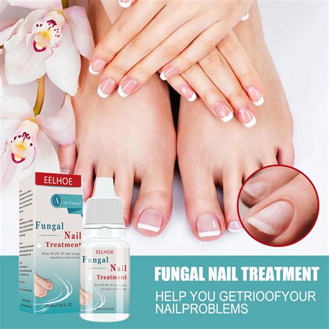 Nail Fungus Cures That Work