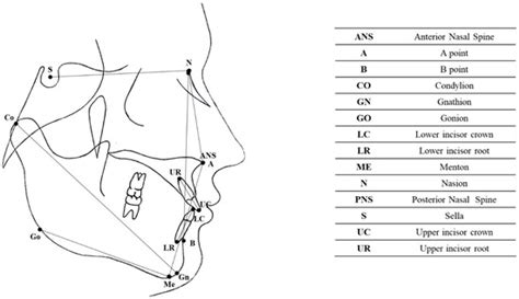 The Efficacy of the RME II System Compared with the Sander Bite-Jumping ...