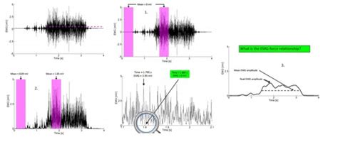 Image result for EMG Exam Example