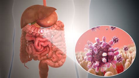 Qué es la gastroenteritis: síntomas y cuidados | LosPrimerosTv
